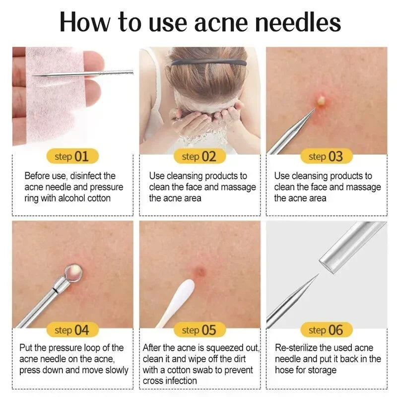 11Pcs Acne Needle Professional Tweezers Acne Remover Ultra-fine No. 5 Cell Pimples Blackhead Clip