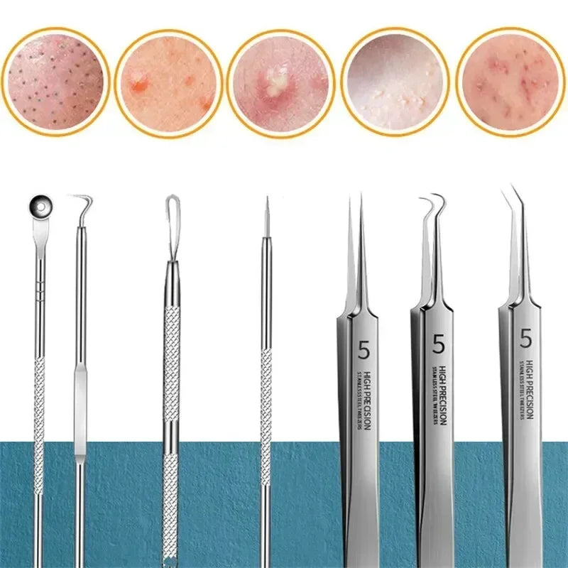 11Pcs Acne Needle Professional Tweezers Acne Remover Ultra-fine No. 5 Cell Pimples Blackhead Clip