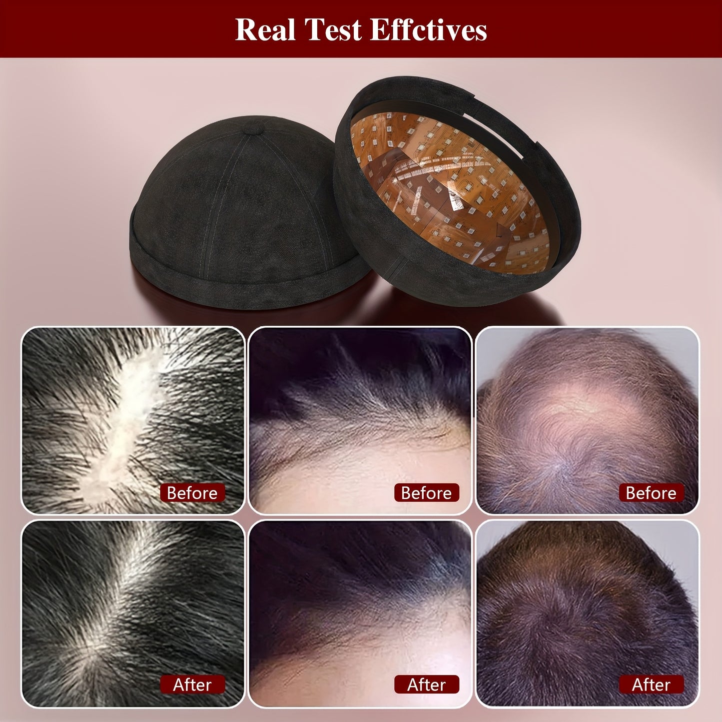 Hair Growth Cap 236 Laser Diodes LLLT Therapy Anti Hair Loss Treatment Restore Hair Thickness